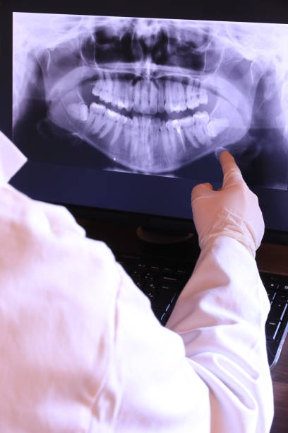 Best Emergency Root Canal Treatment in Suncook, NH
